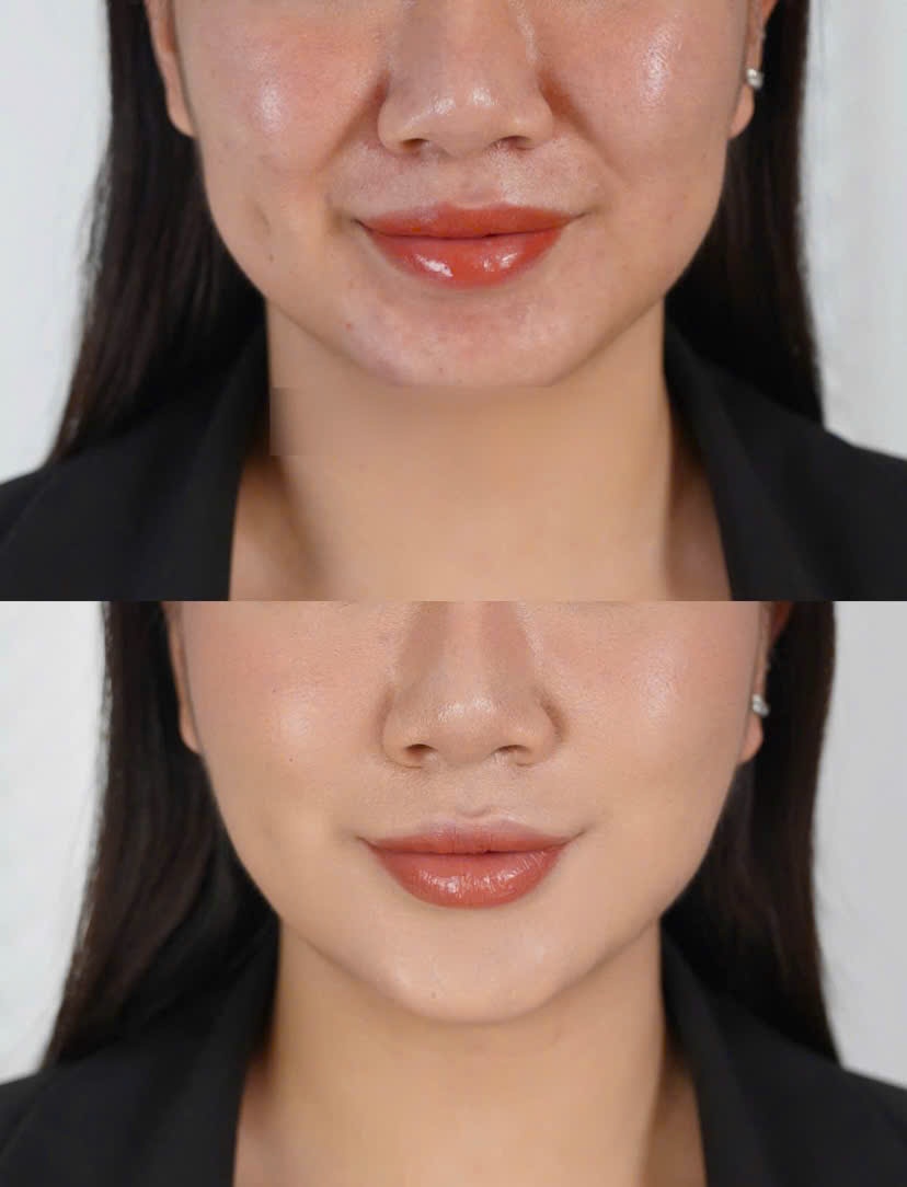 Chấm dứt 