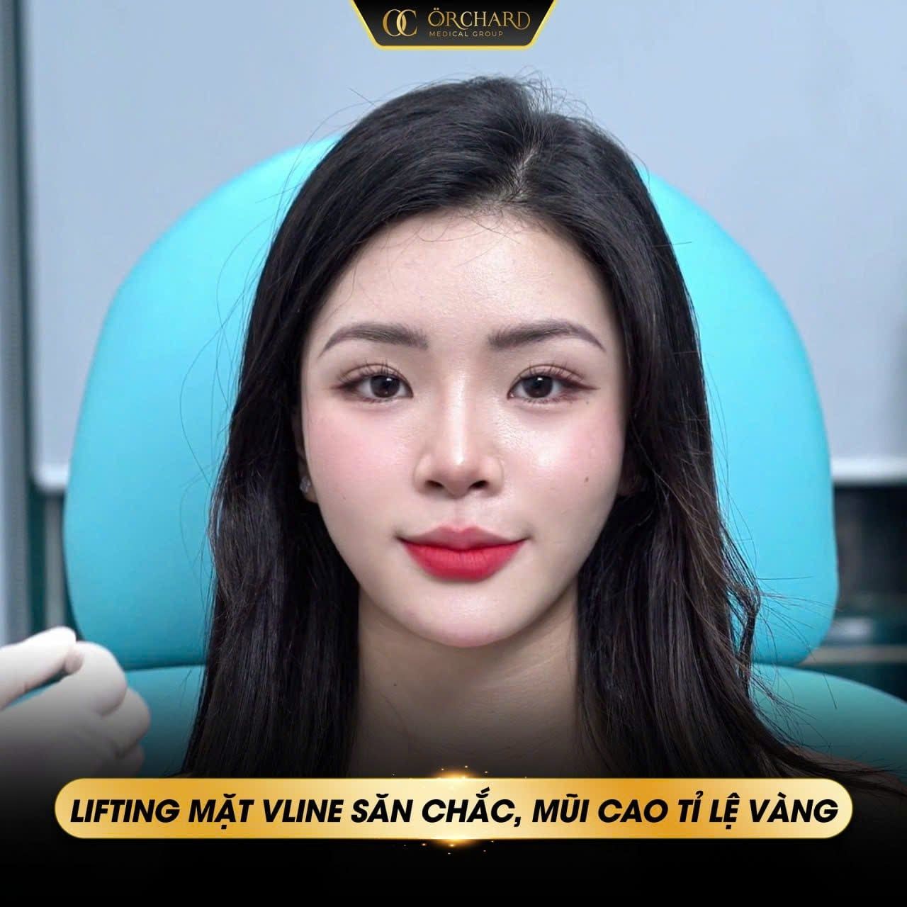 Những ai có thể thực hiện phương pháp nâng mũi bằng chỉ?