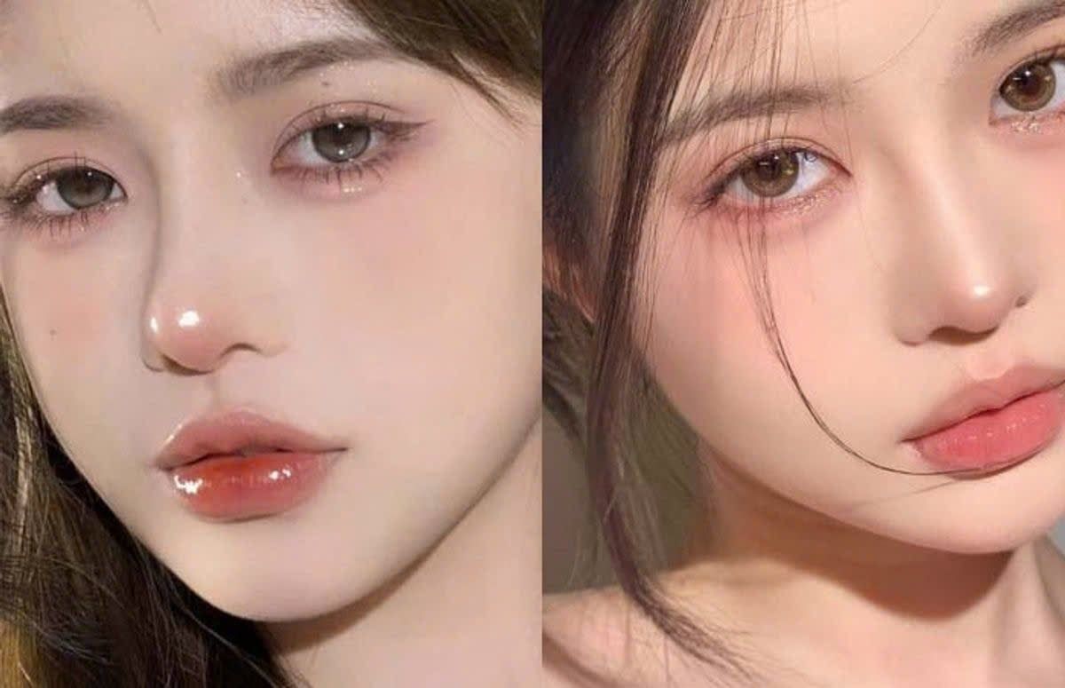 Filler bọng mắt cười – Bí quyết tạo đôi mắt trẻ trung, cuốn hút