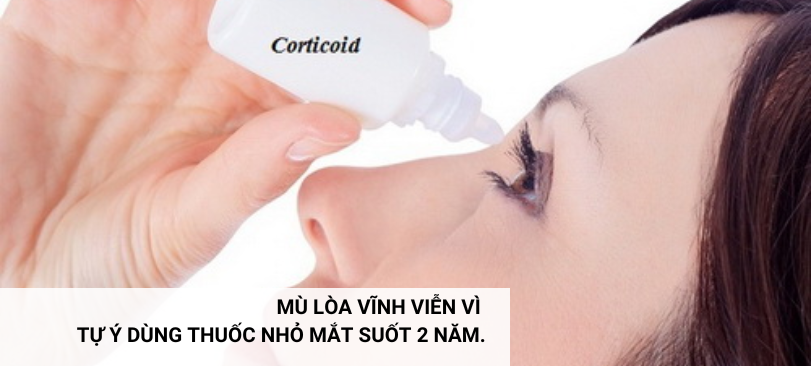 MÙ LÒA VĨNH VIỄN VÌ TỰ Ý DÙNG THUỐC NHỎ MẮT SUỐT 2 NĂM