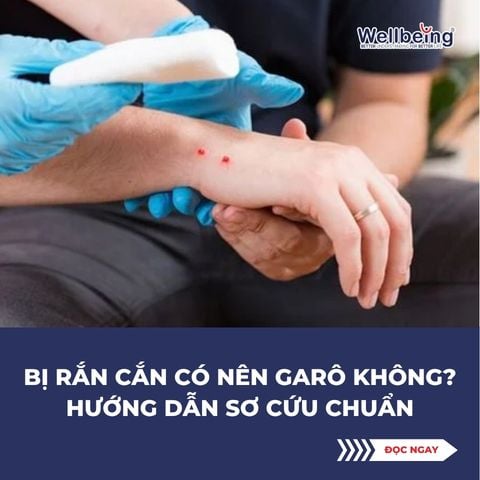 Bị rắn cắn có nên garô không? Hướng dẫn sơ cứu chuẩn