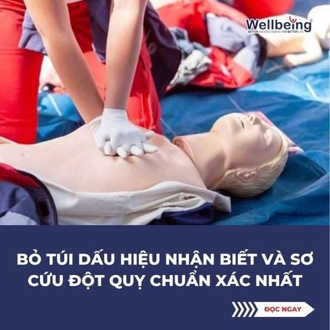 Bỏ túi dấu hiệu nhận biết và sơ cứu đột quỵ chuẩn xác nhất