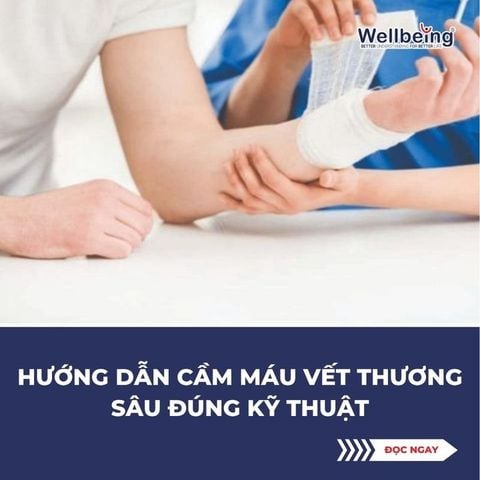 Hướng dẫn cầm máu vết thương sâu đúng kỹ thuật