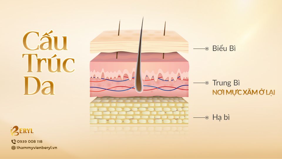 Cảnh báo: Đừng ham rẻ khi xóa xăm!