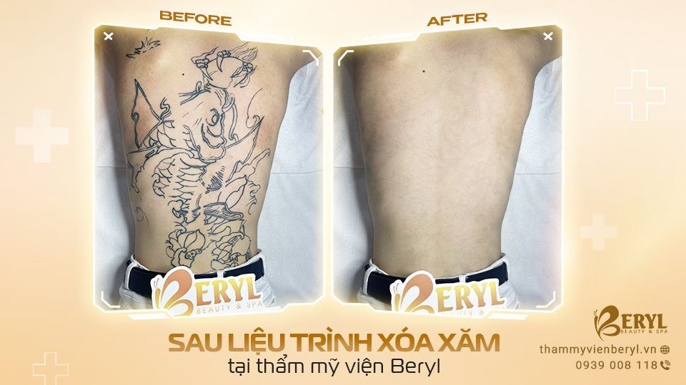 Hình ảnh khách hàng làm tại Beryl