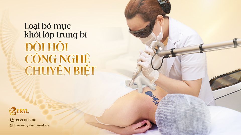 Loại bỏ mực khỏi lớp trung bì đòi hỏi công nghệ chuyên biệt
