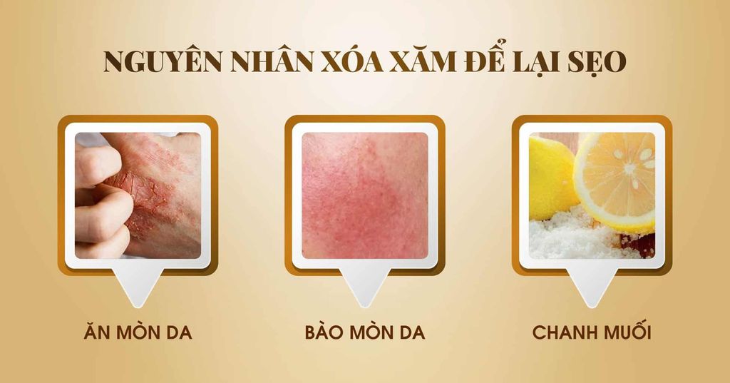 Nguyên nhân xóa xăm để lại sẹo