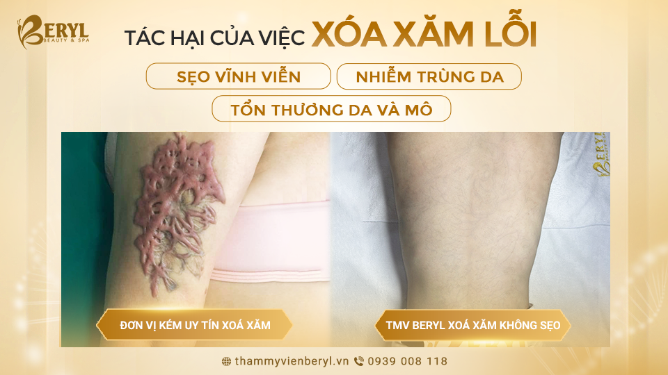 Rủi ro khi xóa hình xăm không đúng cách