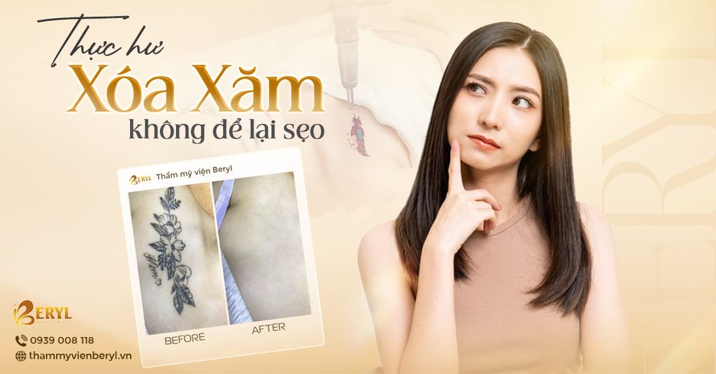 Trước và sau khi xóa xăm tại Beryl