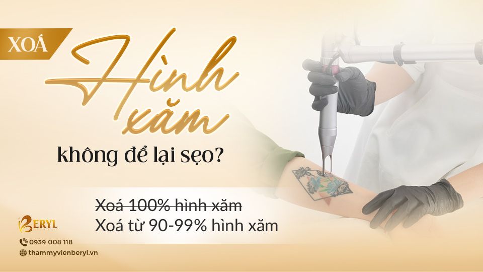 Xóa hình xăm không để lại sẹo
