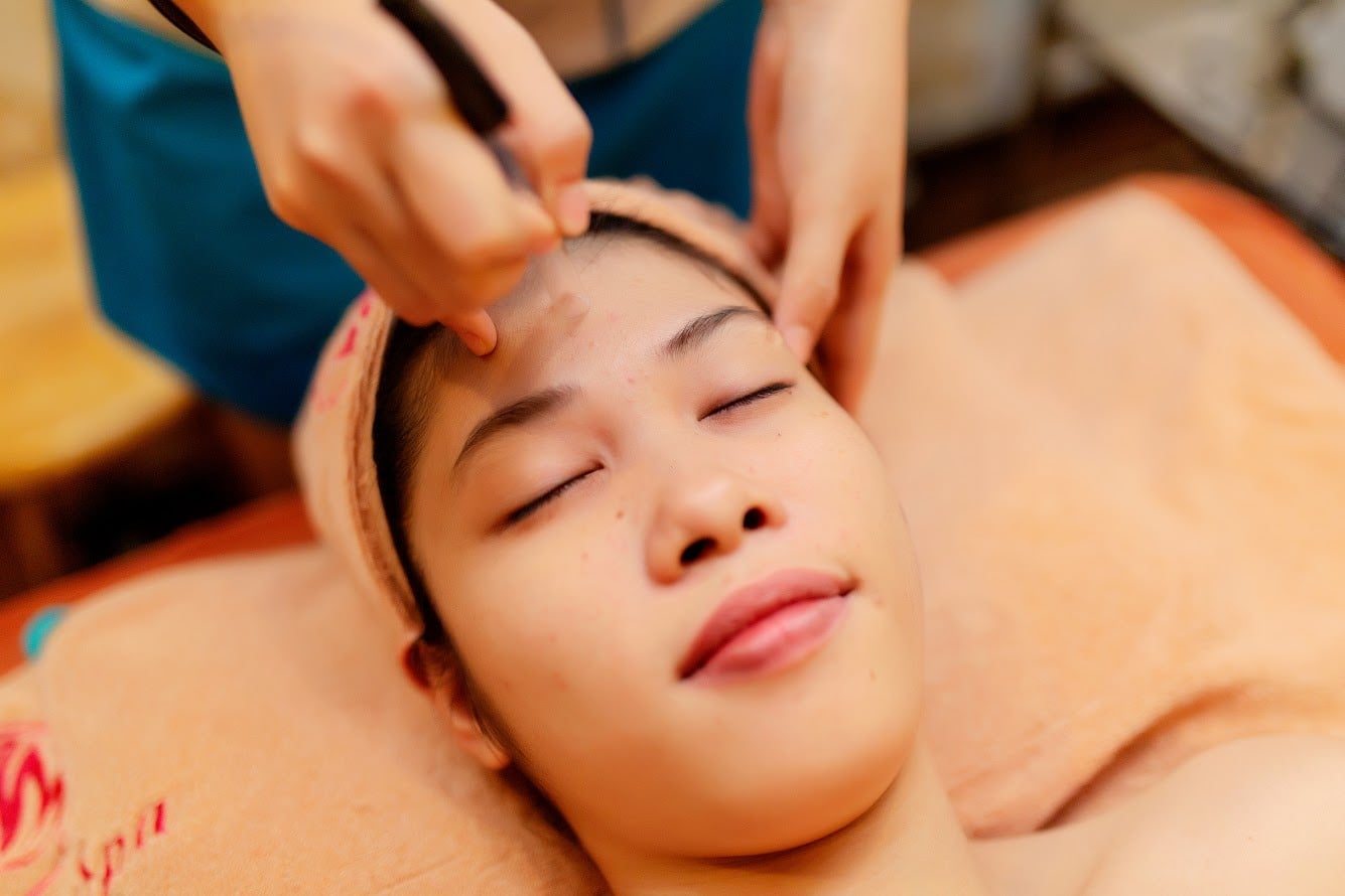 Hướng dẫn chăm sóc da sau khi lấy mụn để tránh sẹo và thâm