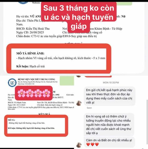 3 tháng không còn hạch tuyến giáp