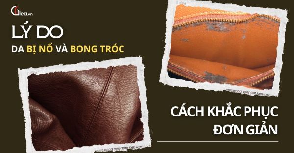 Lý do da bị nổ, bong tróc và cách khắc phục đơn giản