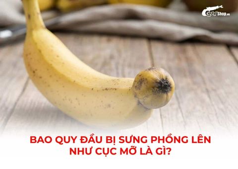 Bao quy đầu bị sưng phồng lên như cục mỡ: Nguyên nhân và cách xử lý