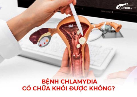 Bệnh chlamydia có chữa khỏi được không? Cách phòng tránh hiệu quả