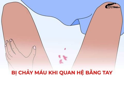 Bị chảy máu khi quan hệ bằng tay: Nguyên nhân và cách phòng tránh