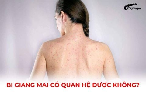 Bị giang mai có quan hệ được không? Những lưu ý quan trọng cần biết
