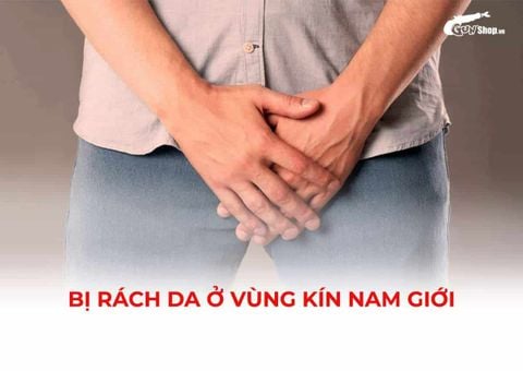Bị rách da ở vùng kín nam giới: Nguyên nhân, dấu hiệu và cách xử lý an toàn