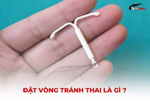 Đặt vòng tránh thai: Khi nào nên đặt và có an toàn không?