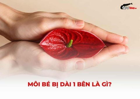 Môi bé bị dài 1 bên: Có sao không, khi nào cần khắc phục?