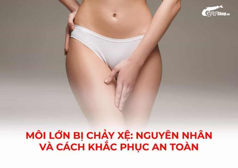 Nguyên nhân và cách khắc phục tình trạng môi lớn chảy xệ an toàn