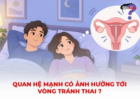 Quan hệ mạnh có ảnh hưởng đến vòng tránh thai? 3 dấu hiệu cảnh báo