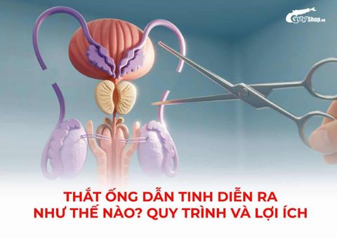 Thắt ống dẫn tinh diễn ra như thế nào? Quy trình và lợi ích