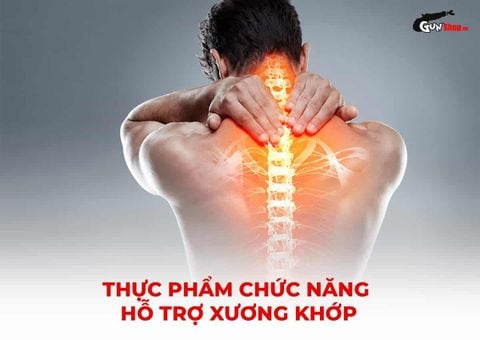 Thực phẩm chức năng hỗ trợ xương khớp: 7 sản phẩm đáng chú ý