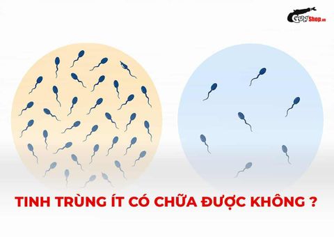 Tinh trùng ít có chữa được không? Khi nào còn cơ hội cải thiện?