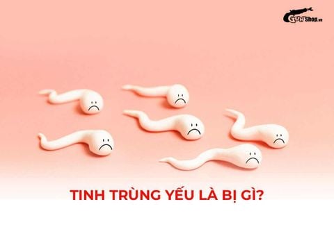 Tinh trùng yếu: Cách nhận biết, nguyên nhân và phòng ngừa