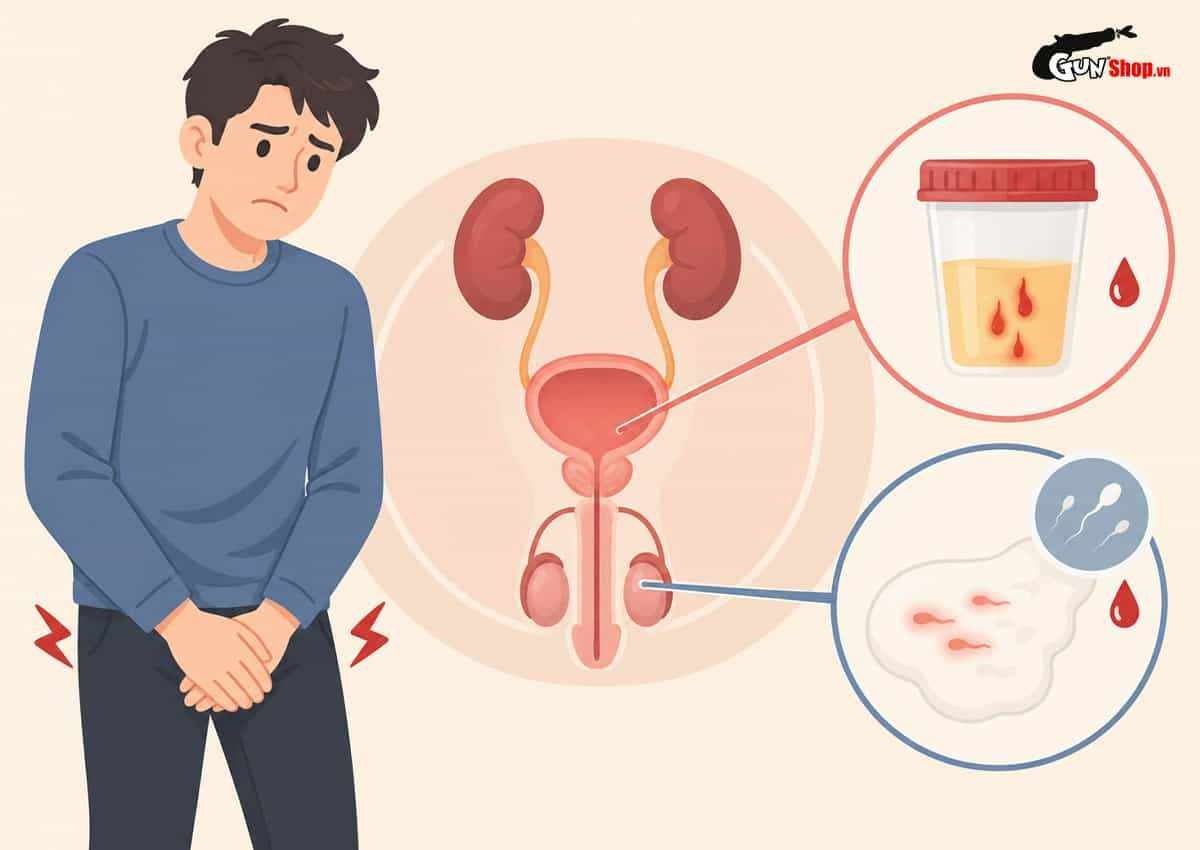 Chảy máu dương vật ở nam giới có sao không?