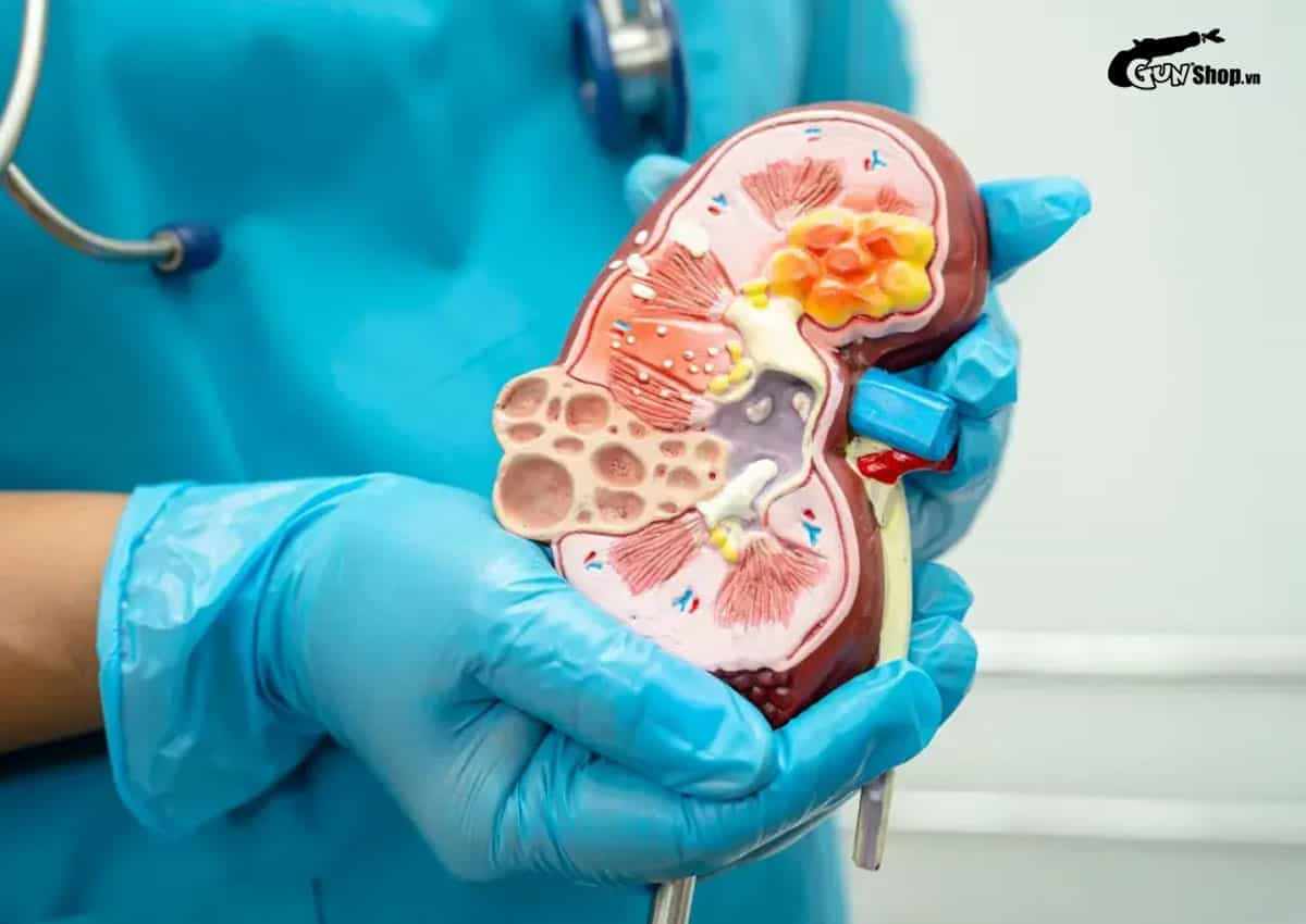 Sau khi mổ sỏi thận bao lâu thì quan hệ lại được?