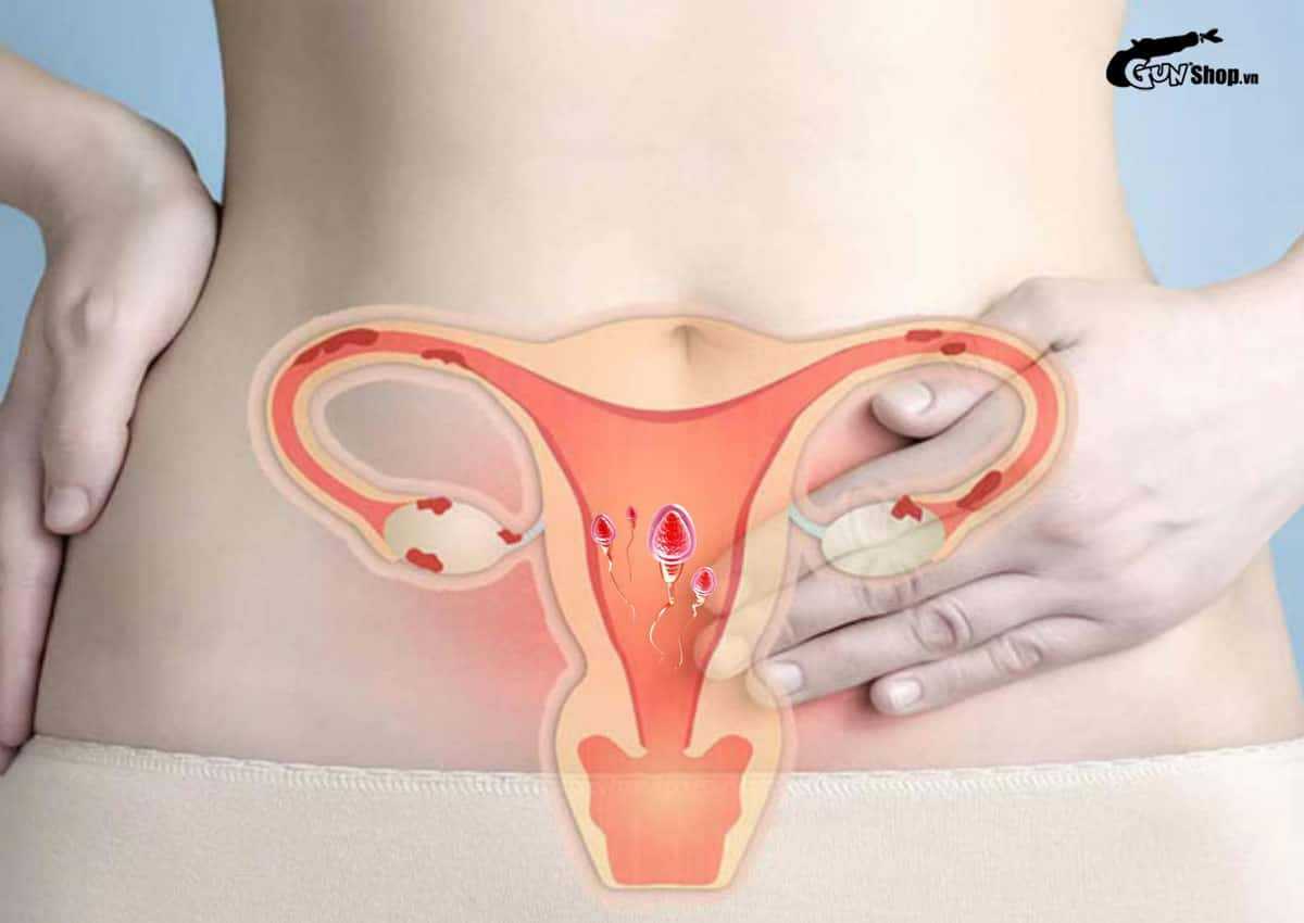 Tinh trùng gặp nước lạnh có chết không?