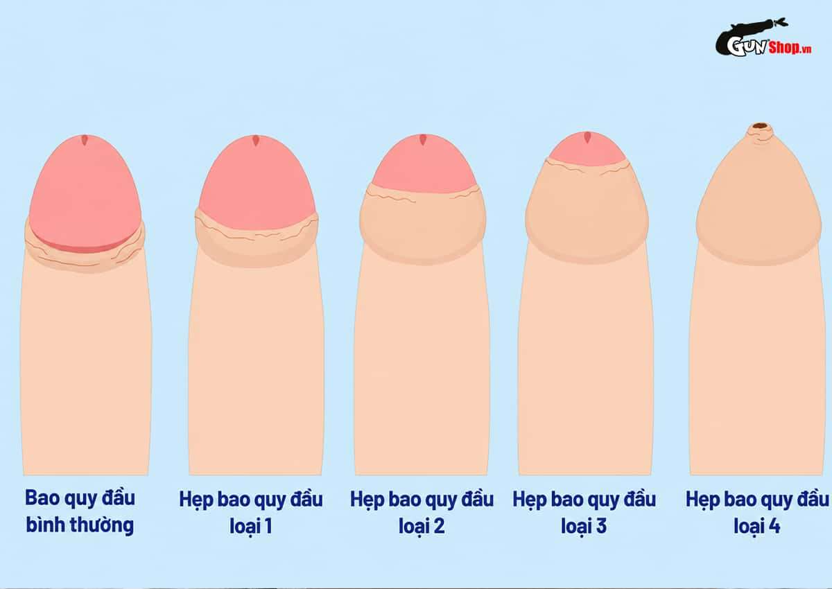 Bao quy đầu là gì?