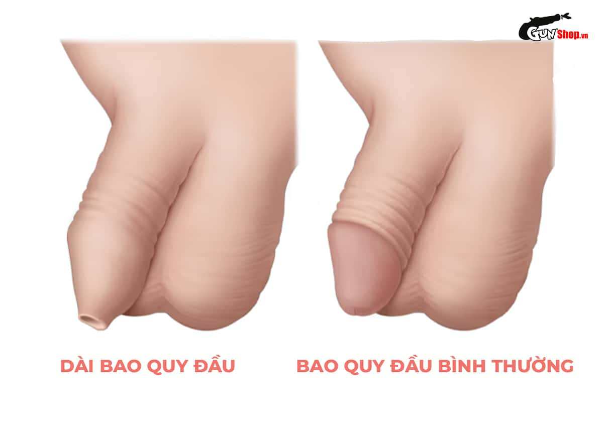 Bao quy đầu là gì?