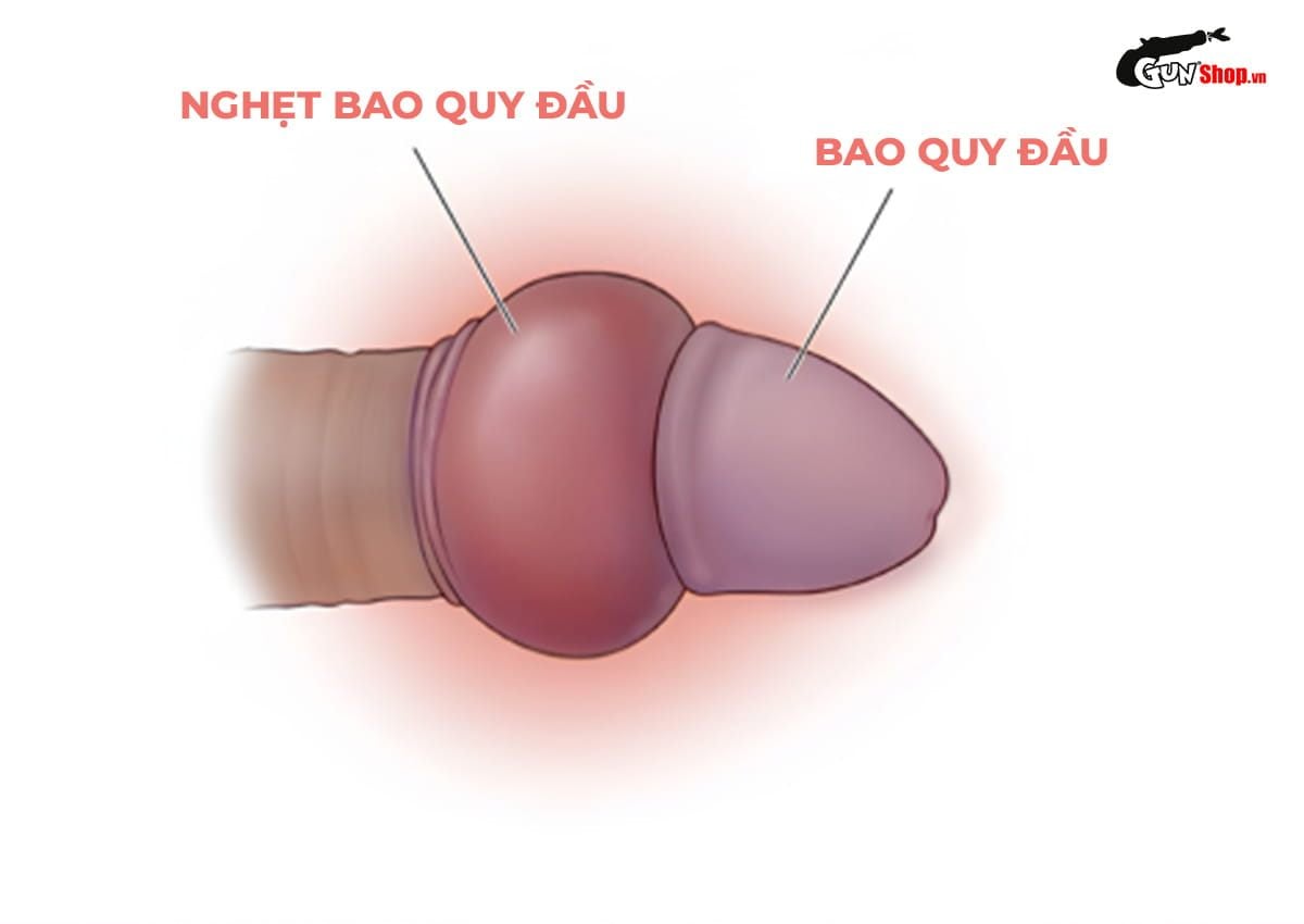Bao quy đầu là gì?
