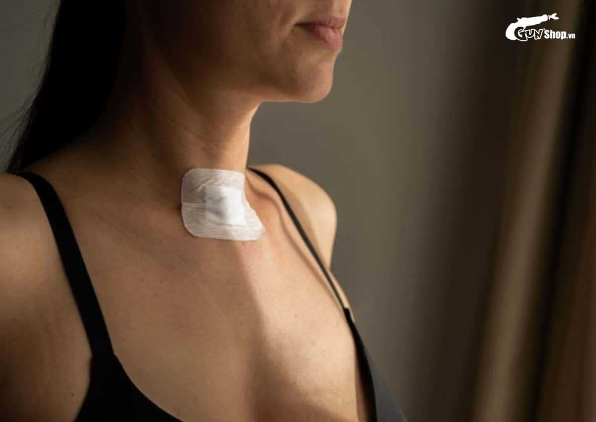 Mổ bướu cổ có kiêng quan hệ vợ chồng không?