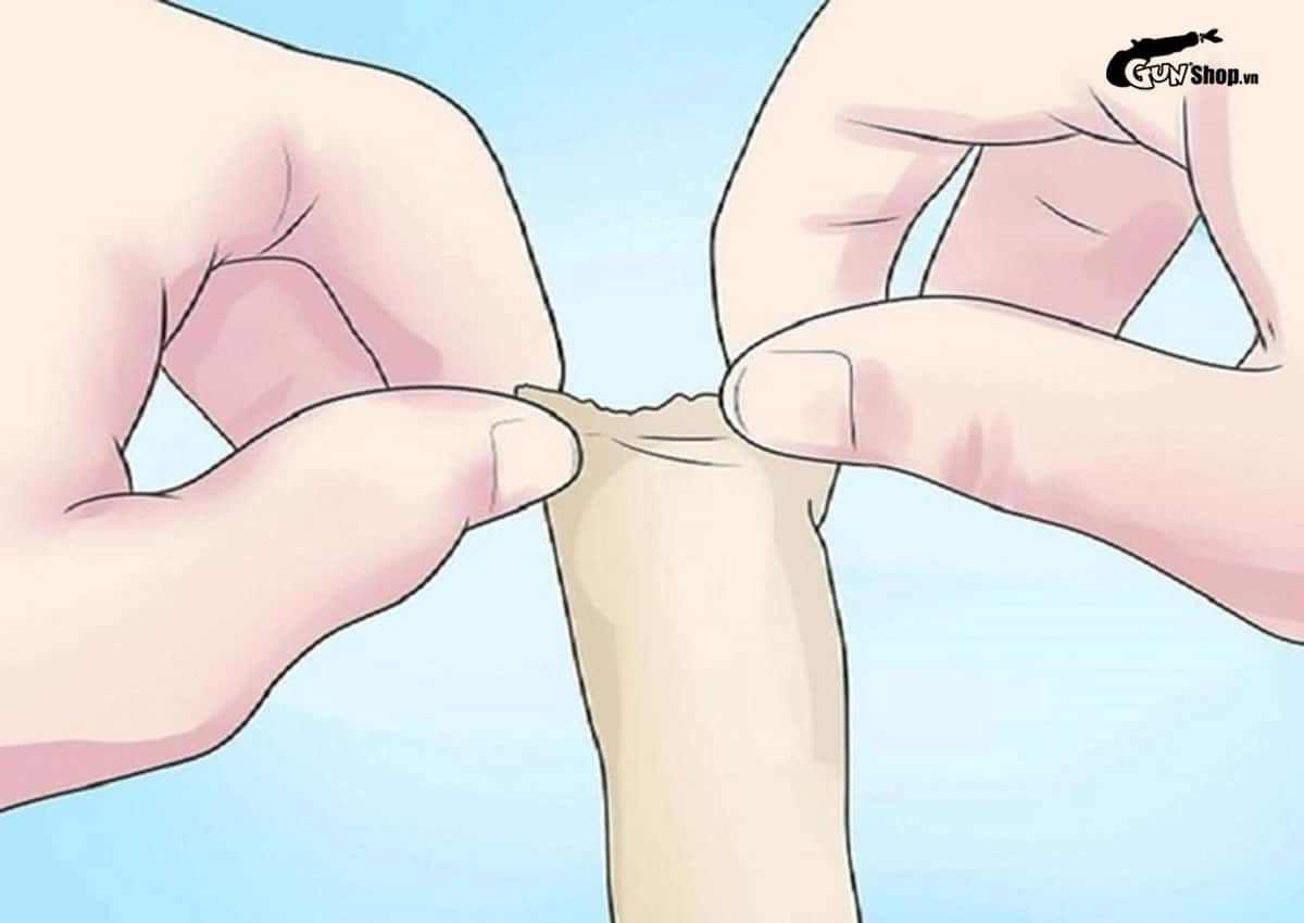 Dài hẹp bao quy đầu là gì?