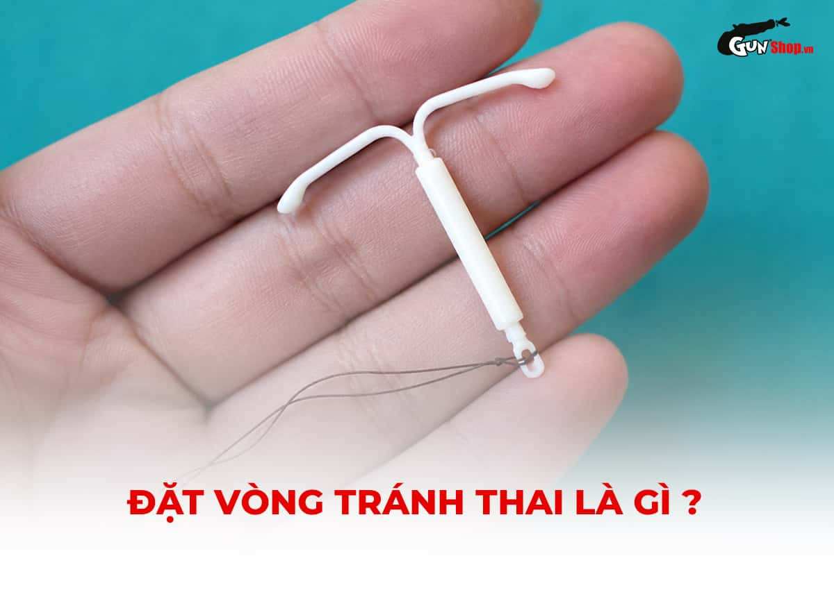 Đặt vòng tránh thai là phương pháp gì?