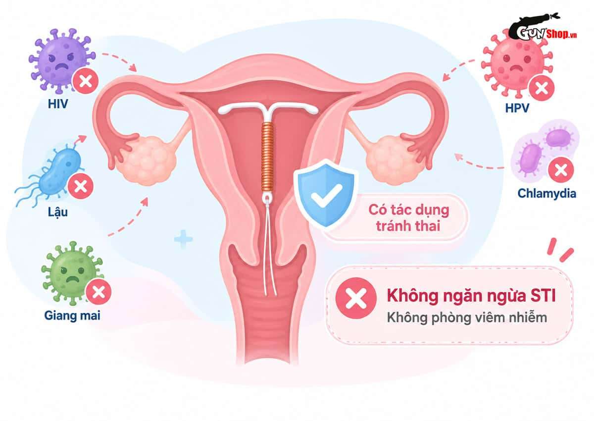 Đặt vòng tránh thai là phương pháp gì?