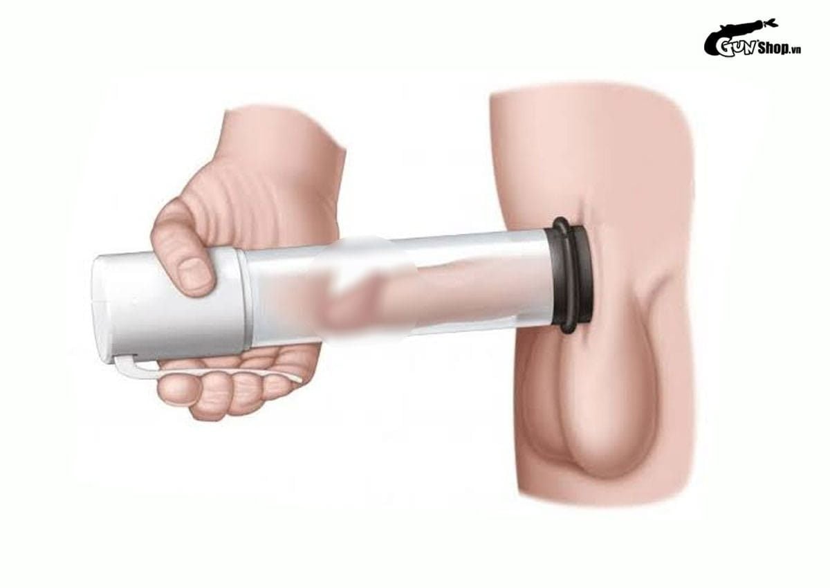 Dương vật bị cong có nguy hiểm không?