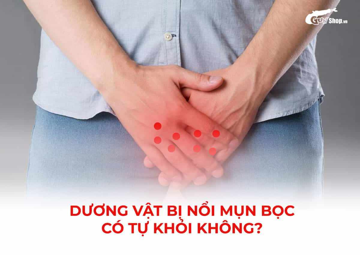 Dương vật bị nổi mụn bọc có tự khỏi không?