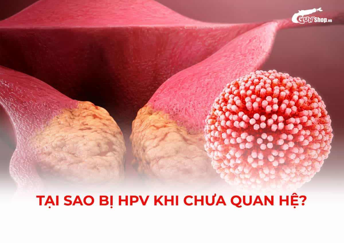 Tại sao bị HPV khi chưa quan hệ?