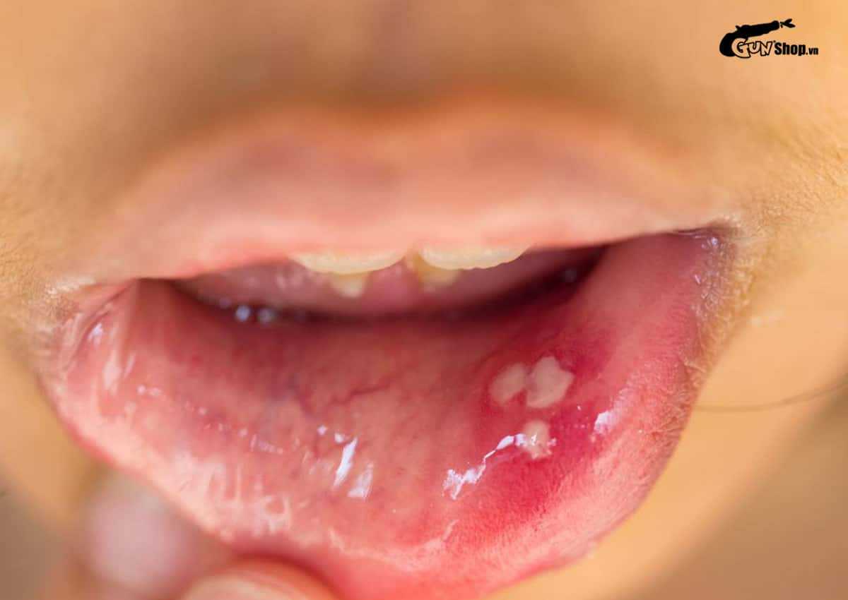 Quan hệ bằng miệng là gì?