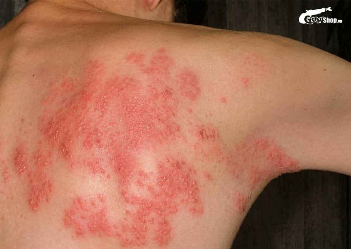 Tác hại của ghế tình yêu nếu sử dụng sai cách