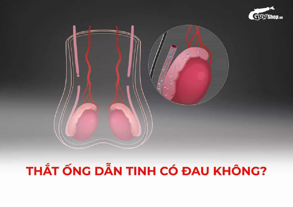 Thắt ống dẫn tinh có đau không?