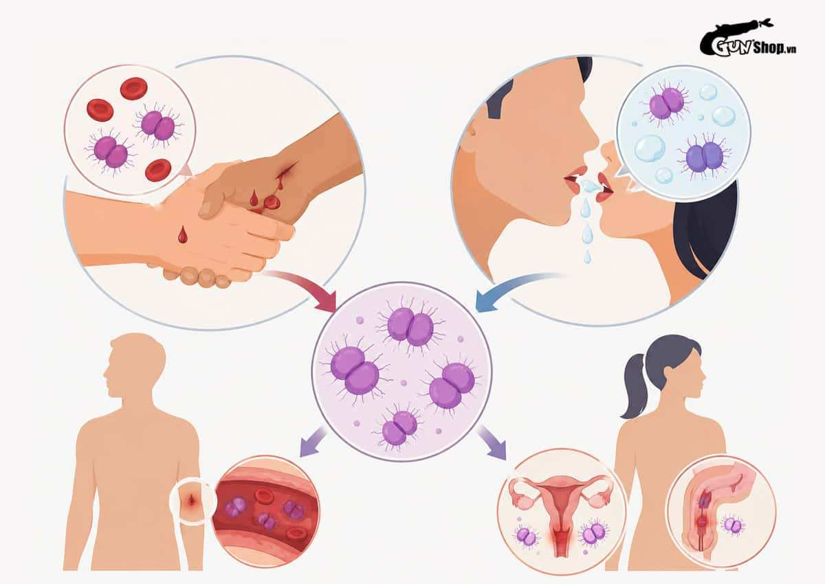 Vi khuẩn Neisseria Gonorrhoeae gây bệnh gì?