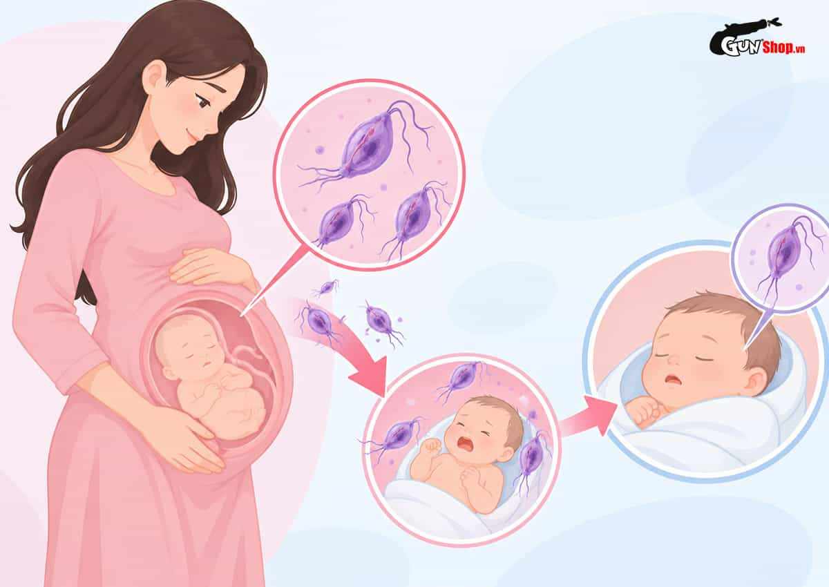 Viêm âm đạo do Trichomoniasis