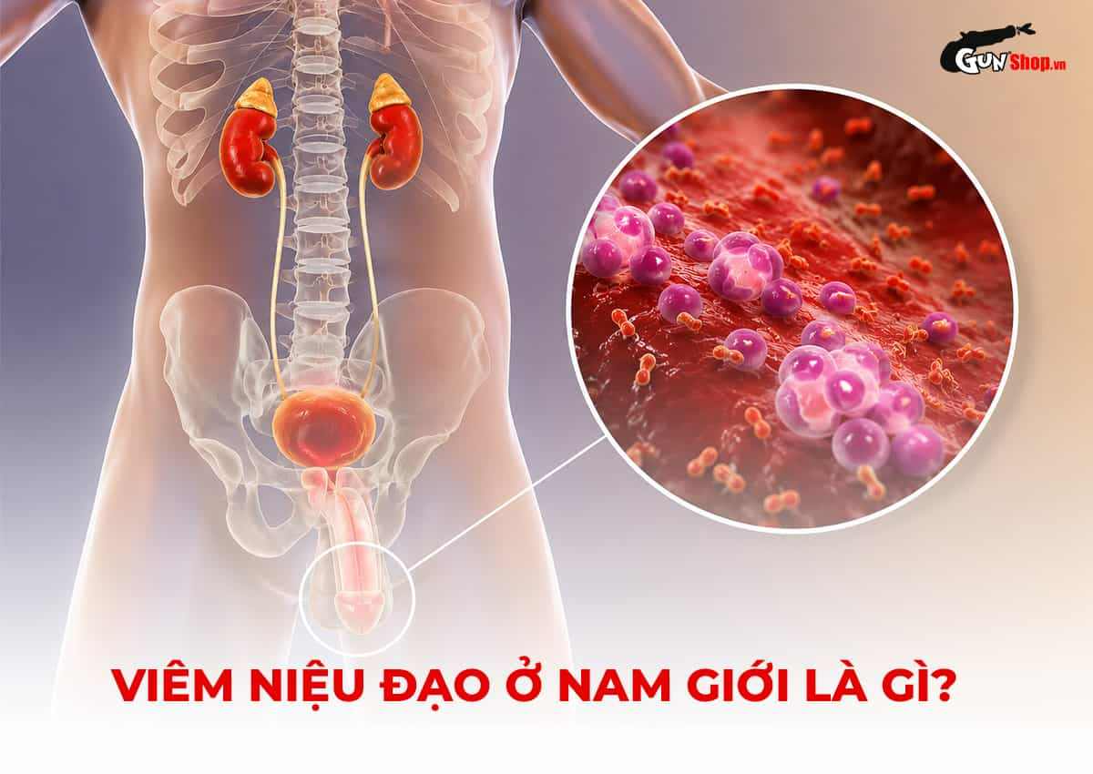 Viêm niệu đạo ở nam giới