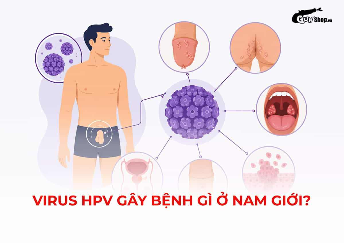 Virus HPV gây bệnh gì ở nam giới?